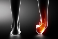 How Ankle Sprains Occur