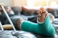 Common Causes and Definition of a Broken Foot