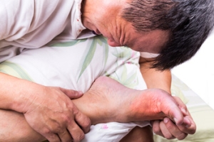 Managing Painful Gout