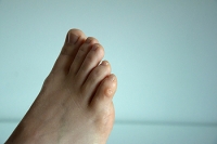 How to Get Rid of Corns on Your Feet