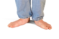 Flat Foot Diagnosis
